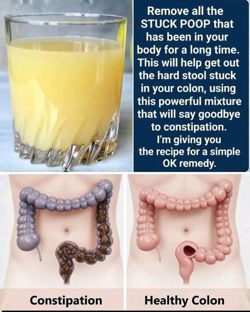 Can a Homemade Drink Really "Clean Out" Your Colon? The Truth About Constipation Remedies 753150697_1036306932221861_7246717228199020650_n