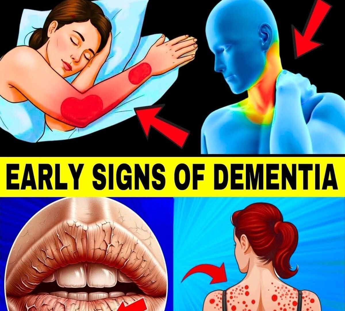 10 Early Signs of Dementia You Should Never Ignore 781869449_1114932797527363_1837587711353865967_n