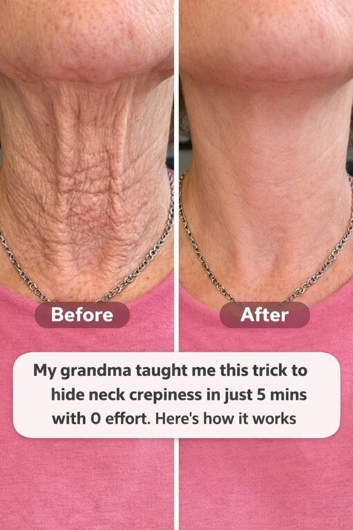 How to Make Neck Skin Look Smoother in 5 Minutes: A Simple Skincare Routine 784351602_122098834473455201_5208449291686729469_n