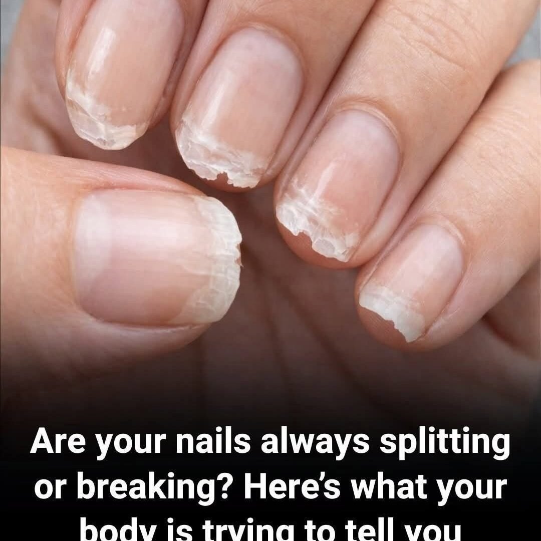 Weak or Brittle Nails: What Your Body Might Be Trying to Tell You 786467968_122096989899461141_2083137713618343423_n
