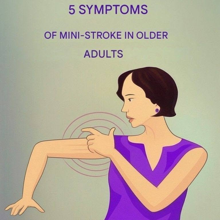 5 Symptoms of a Mini-Stroke in Older Adults That Should Never Be Ignored 788641089_122097114795461632_1144532100498762512_n