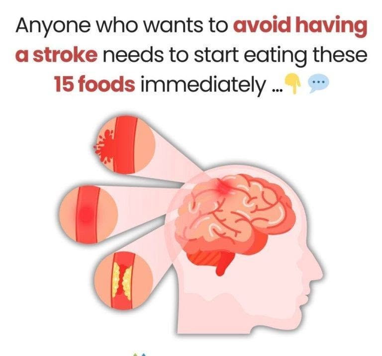 The 15 Foods That Can Dramatically Lower Your Stroke Risk 808469497_2116927479245377_6211664061477018428_n