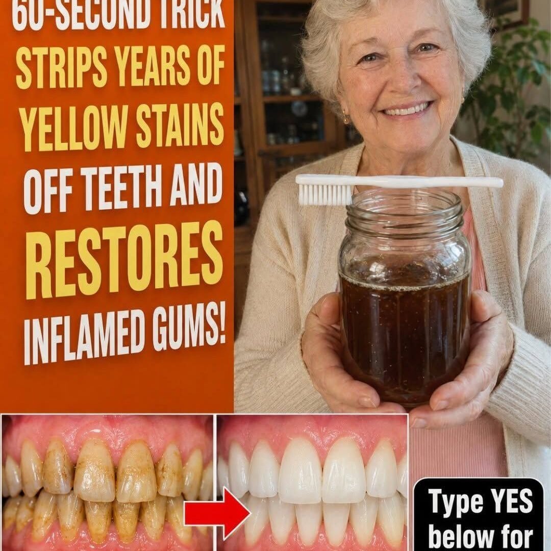 "60-Second Trick Strips Years of Yellow Stains"? What Your Dentist Wants You to Know Before Trying It 811236041_1050204354734860_3801574649856274659_n